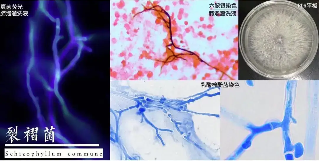 夫妻同時發熱咳嗽，撬開地板後震驚了！醫生提醒→