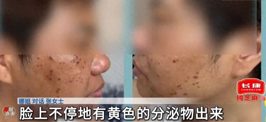 “半小時內不交1萬元就會毀容！”女子帶母親做美容遭強制消費，相關部門回應